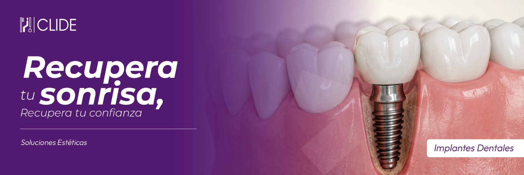 Dentistas Clide Guatemala
